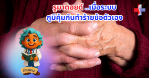 Rheumatoid Arthritis