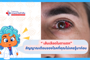 Eye bleed (3)